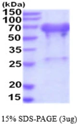 Human UBQLN2 protein, His tag. GTX68452-pro