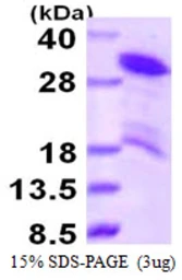 Human HDGFRP3 protein, His tag. GTX68458-pro