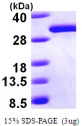 Human DCXR protein, His tag. GTX68485-pro