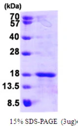 Human GLRX5 protein, His tag. GTX68487-pro