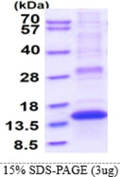 Human PLAC8 protein, His tag. GTX68500-pro
