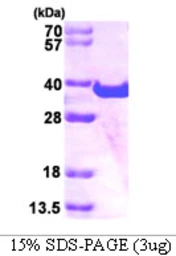 Human SPG21 protein, His tag. GTX68501-pro