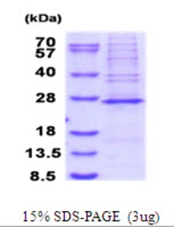 Human MRPS23 protein, His tag. GTX68527-pro