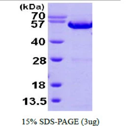 Human HAO1 protein, His tag. GTX68546-pro