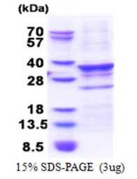 Human CENPQ protein, His tag. GTX68576-pro