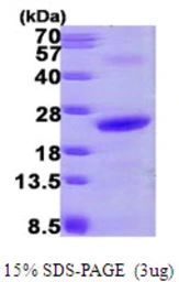 Human NHP2 protein, His tag. GTX68603-pro