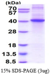 Human DOK4 protein, His tag. GTX68607-pro