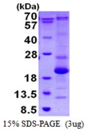 Human ASF1B protein, His tag. GTX68608-pro
