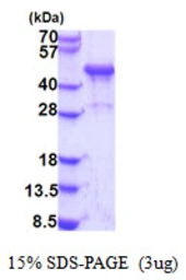 Human NDRG3 protein, His tag. GTX68660-pro