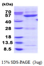 Human GBA3 protein, His tag. GTX68664-pro