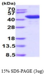 Mouse HDAC8 protein, His tag. GTX68713-pro