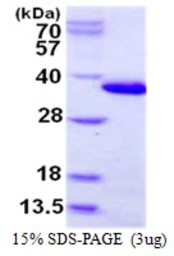 Human CHMP6 protein, His tag. GTX68735-pro