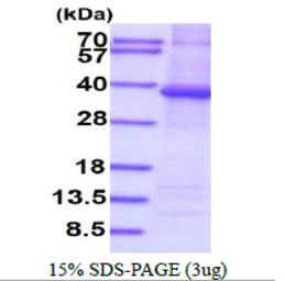 Human PPP1R3B protein, His tag. GTX68736-pro