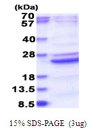 Human B9D2 protein, His tag. GTX68763-pro