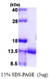 Human URM1 protein, His tag. GTX68770-pro