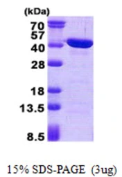 Human CAB39L protein, His tag. GTX68772-pro
