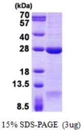 Human DNAL1 protein, His tag. GTX68781-pro