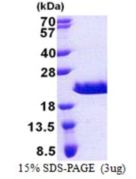 Human RPA Interacting Protein protein, His tag. GTX68802-pro