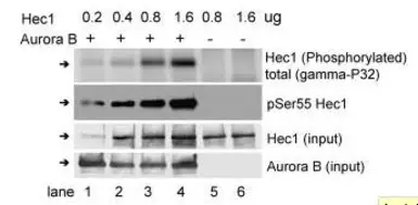 Anti-Hec1 (phospho Ser 55) antibody used in Western Blot (WB). GTX70017
