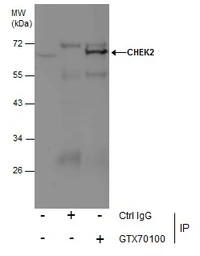 Anti-Chk2 antibody [4B8] used in Immunoprecipitation (IP). GTX70100