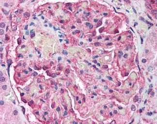 Anti-ATM antibody [2C1] used in IHC (Paraffin sections) (IHC-P). GTX70103