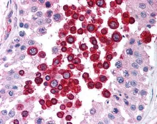 Anti-ATM antibody [2C1] used in IHC (Paraffin sections) (IHC-P). GTX70103