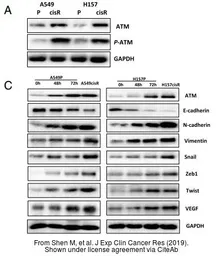 Anti-ATM antibody [2C1] used in Western Blot (WB). GTX70103