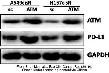 Anti-ATM antibody [2C1] used in Western Blot (WB). GTX70103
