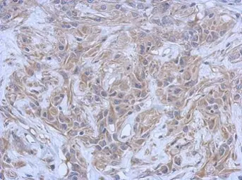 Anti-ATM antibody [3E8] used in IHC (Paraffin sections) (IHC-P). GTX70105