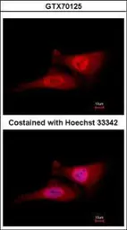 Anti-CDC34 antibody [14B5] used in Immunocytochemistry/ Immunofluorescence (ICC/IF). GTX70125