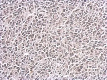 Anti-CENPF antibody [14C10 1D8] used in IHC (Paraffin sections) (IHC-P). GTX70137