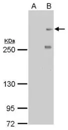 Anti-CENPF antibody [14C10 1D8] used in Western Blot (WB). GTX70137