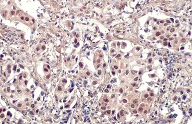 Anti-E2F1 antibody [17E2] used in IHC (Paraffin sections) (IHC-P). GTX70154