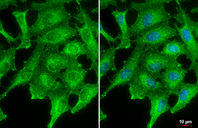 Anti-PNPase antibody [4C11] used in Immunocytochemistry/ Immunofluorescence (ICC/IF). GTX70159