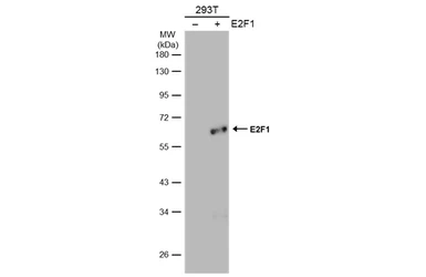 Anti-E2F1 antibody [6B5] used in Western Blot (WB). GTX70167