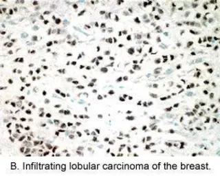 Anti-Estrogen Receptor beta antibody [14C8] used in  (). GTX70174