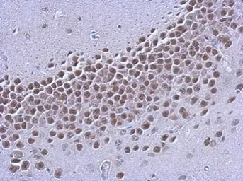 Anti-Estrogen Receptor beta antibody [4D2] used in IHC (Paraffin sections) (IHC-P). GTX70176