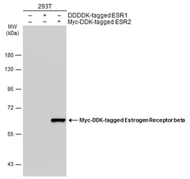 Anti-Estrogen Receptor beta antibody [4D2] used in Western Blot (WB). GTX70176