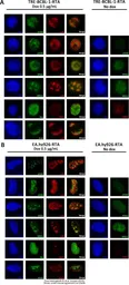 Anti-Mre11 antibody [12D7] used in Immunocytochemistry/ Immunofluorescence (ICC/IF). GTX70212
