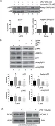 Anti-Nuclear Matrix Protein p84 antibody [5E10] used in Western Blot (WB). GTX70220