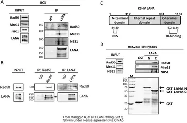 Anti-Rad50 antibody [13B3] used in Western Blot and Immunoprecipitation (WB IP). GTX70228