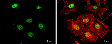 Anti-Rad50 antibody [13B3] used in Immunocytochemistry/ Immunofluorescence (ICC/IF). GTX70228