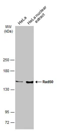 Anti-Rad50 antibody [13B3] used in Western Blot (WB). GTX70228