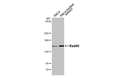 Anti-Rad50 antibody [13B3] used in Western Blot (WB). GTX70228