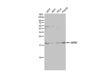 Anti-GPX7 antibody [2704] used in Western Blot (WB). GTX70266
