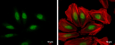 Anti-XPC antibody [3.26] used in Immunocytochemistry/ Immunofluorescence (ICC/IF). GTX70294