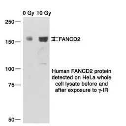 Anti-FANCD2 antibody [6] used in Western Blot (WB). GTX70314