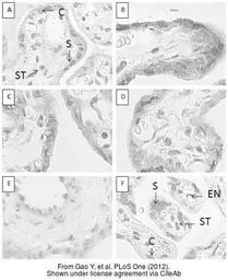 Anti-Human Endogenous Retrovirus antibody used in IHC (Paraffin sections) (IHC-P). GTX70327
