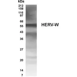 Anti-Human Endogenous Retrovirus antibody used in Western Blot (WB). GTX70327