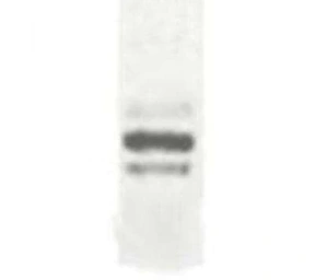 Anti-DCBLD2 antibody used in Western Blot (WB). GTX70450